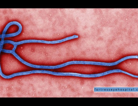 ebola-virus