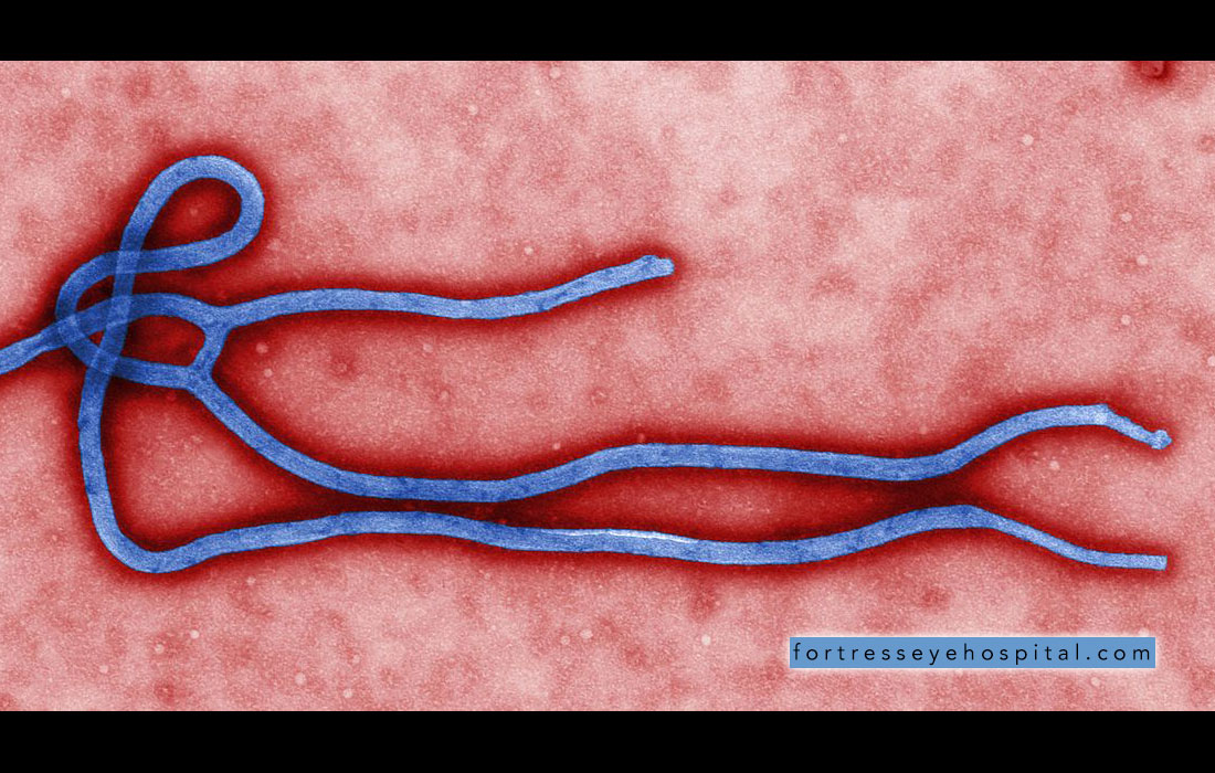 ebola-virus